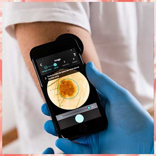 Doctors can now predict skin cancer severity using AI