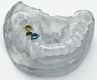 Objet launches Bio-Compatible 3D printing Material