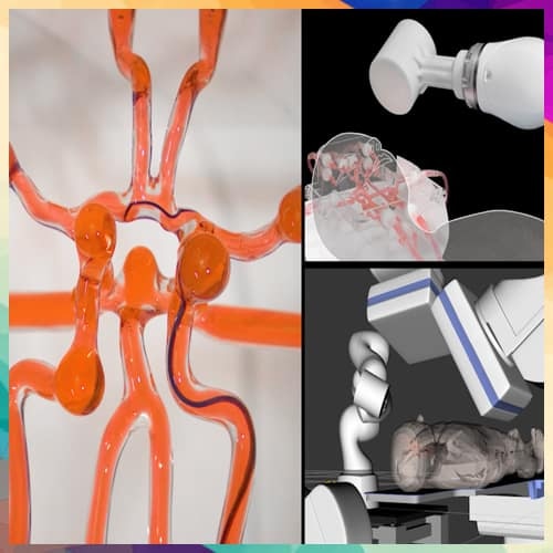 MIT engineers developed joystick-operated robot to treat stroke remotely
