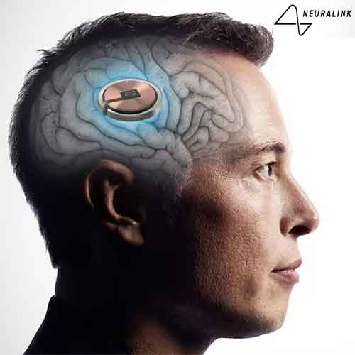 Neuralink’s First Brain Chip User Prioritizes Tech Over Musk