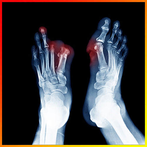 University of California Researchers develop gel to cure wounds that don't heal easily