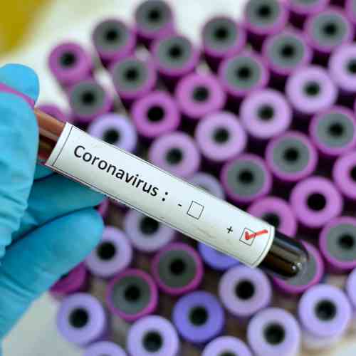 Mobile accessories and electronics devices market feel the heat of Coronavirus Mobile accessories and electronics devices market feel the heat of Coronavirus