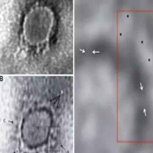 Indian scientists capture image of novel coronavirus causing Covid-19 Indian scientists capture image of novel coronavirus causing Covid-19