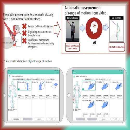 Fujitsu Launches AI-powered Physical Rehabilitation Solution 'HOPE ROMREC'
