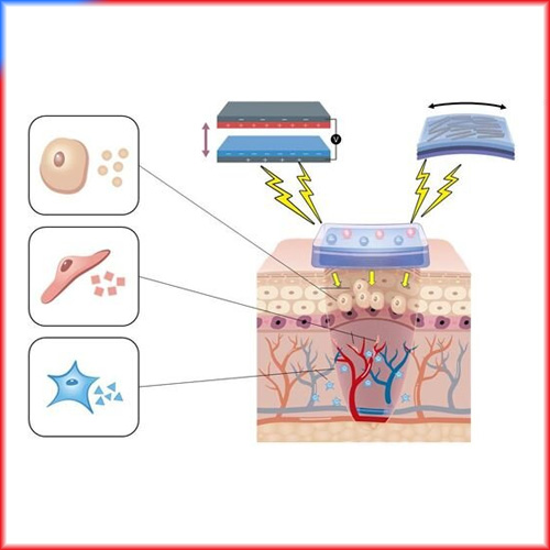 Tiny electric generators could accelerate wound healing
